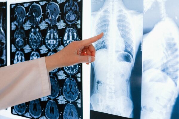 prayer for brain surgery